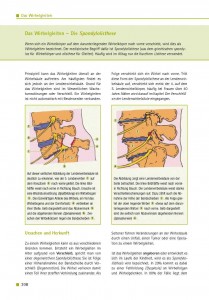 Das Wirbelgleiten – Die Spondylolisthese